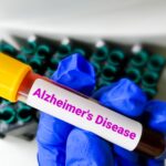 Alzheimer's