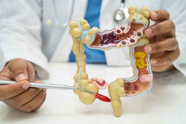 Appendicitis