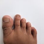 Toes