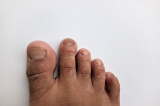 Toes