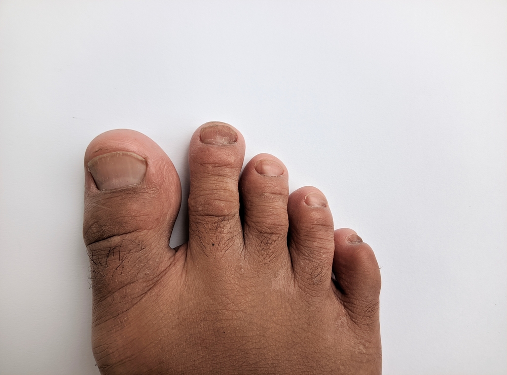 Toes