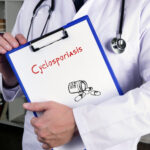Cyclosporiasis