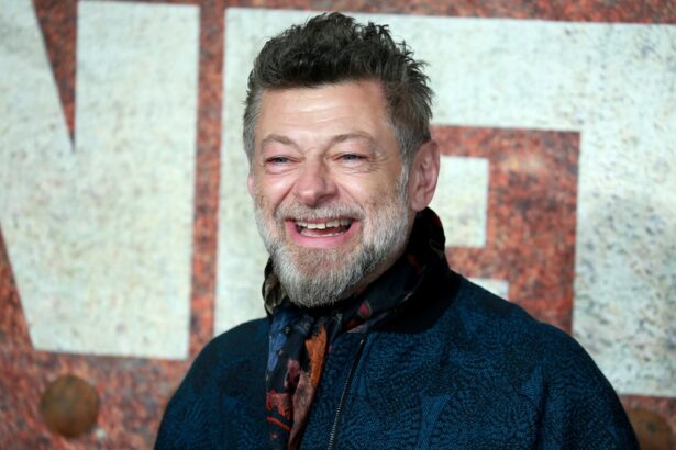 Serkis