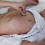 Pennsylvania measles outbreak